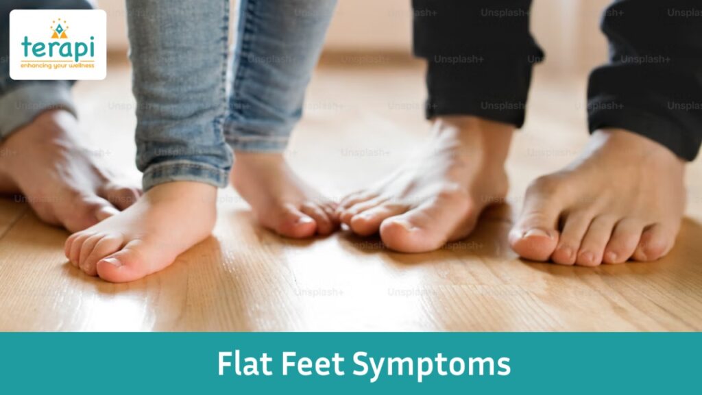 Flat Feet