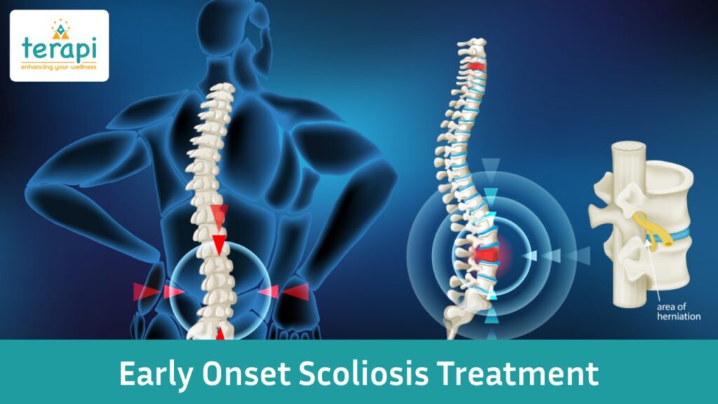 Scoliosis Treatment for Children